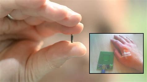 rfid chip tumor|microchips for cancer.